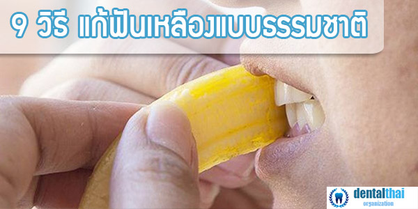 9 วิธีแก้ฟันเหลืองแบบธรรมชาติ