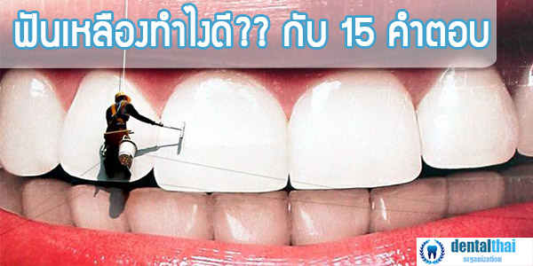ฟันเหลืองทำไงดี กับ 15 คำตอบ ที่ช่วยให้คุณฟันขาวได้เหมือนใหม่